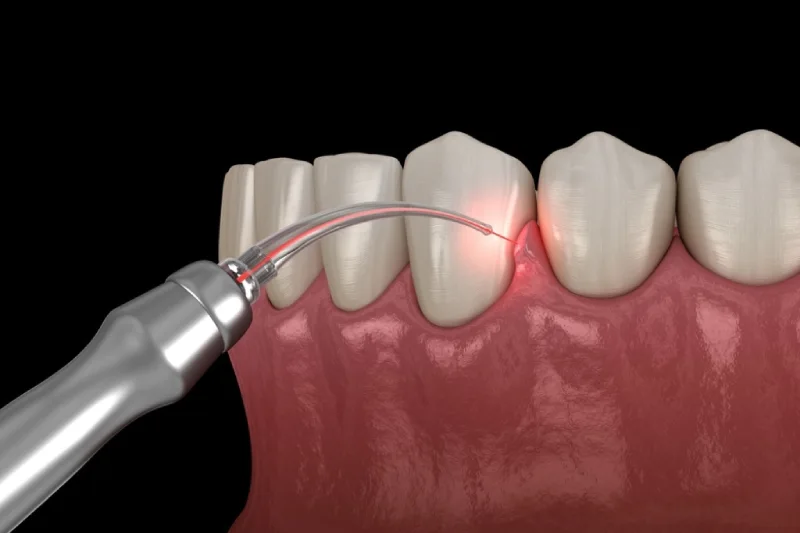 GN Dental Yuba City | Soft Tissue Periodontics GN Dental Yuba City | Soft Tissue Periodontics