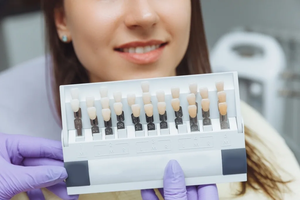 GN Dental Yuba City | Composite Veneers GN Dental Yuba City | Composite Veneers
