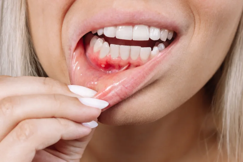 GN Dental Yuba City | Gum Disease Treatment GN Dental Yuba City | Gum Disease Treatment