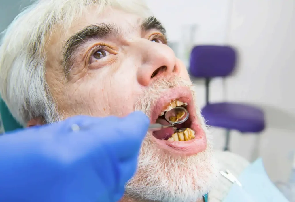 GN Dental Yuba City | Conditions We Treat GN Dental Yuba City | Conditions We Treat