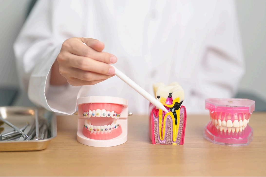 GN Dental Yuba City | Conditions We Treat GN Dental Yuba City | Conditions We Treat