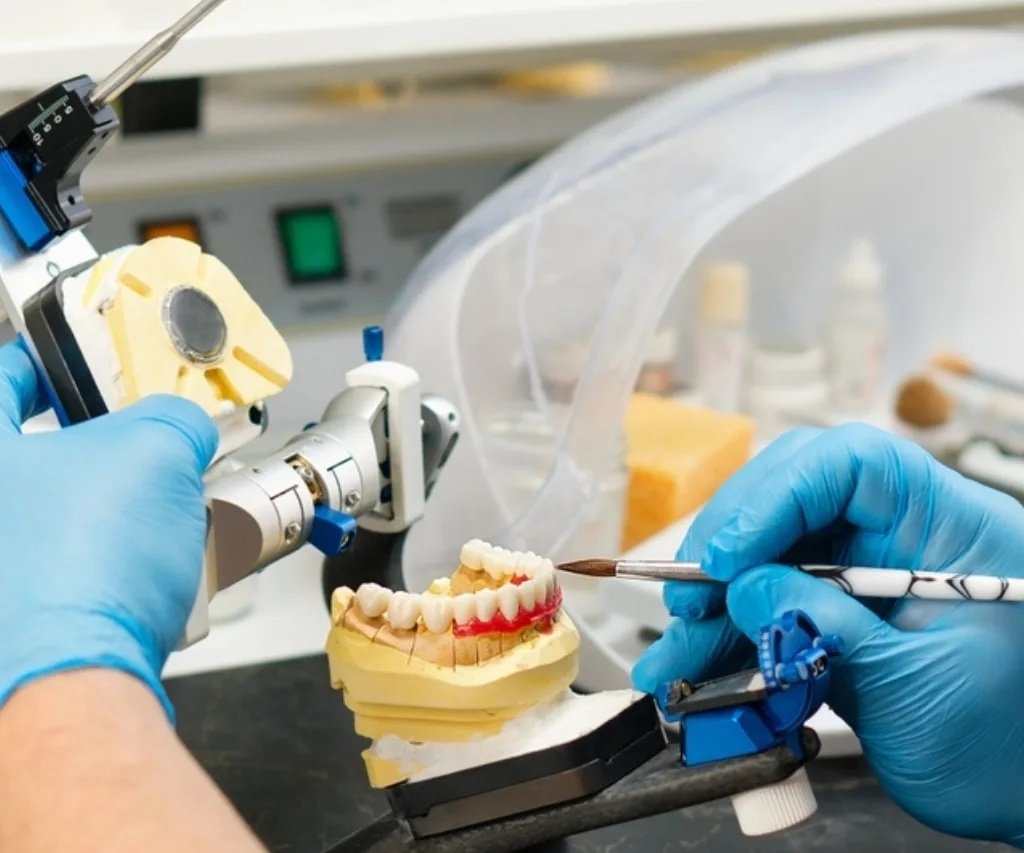 GN Dental Yuba City | Dental Crowns & Bridges GN Dental Yuba City | Dental Crowns & Bridges