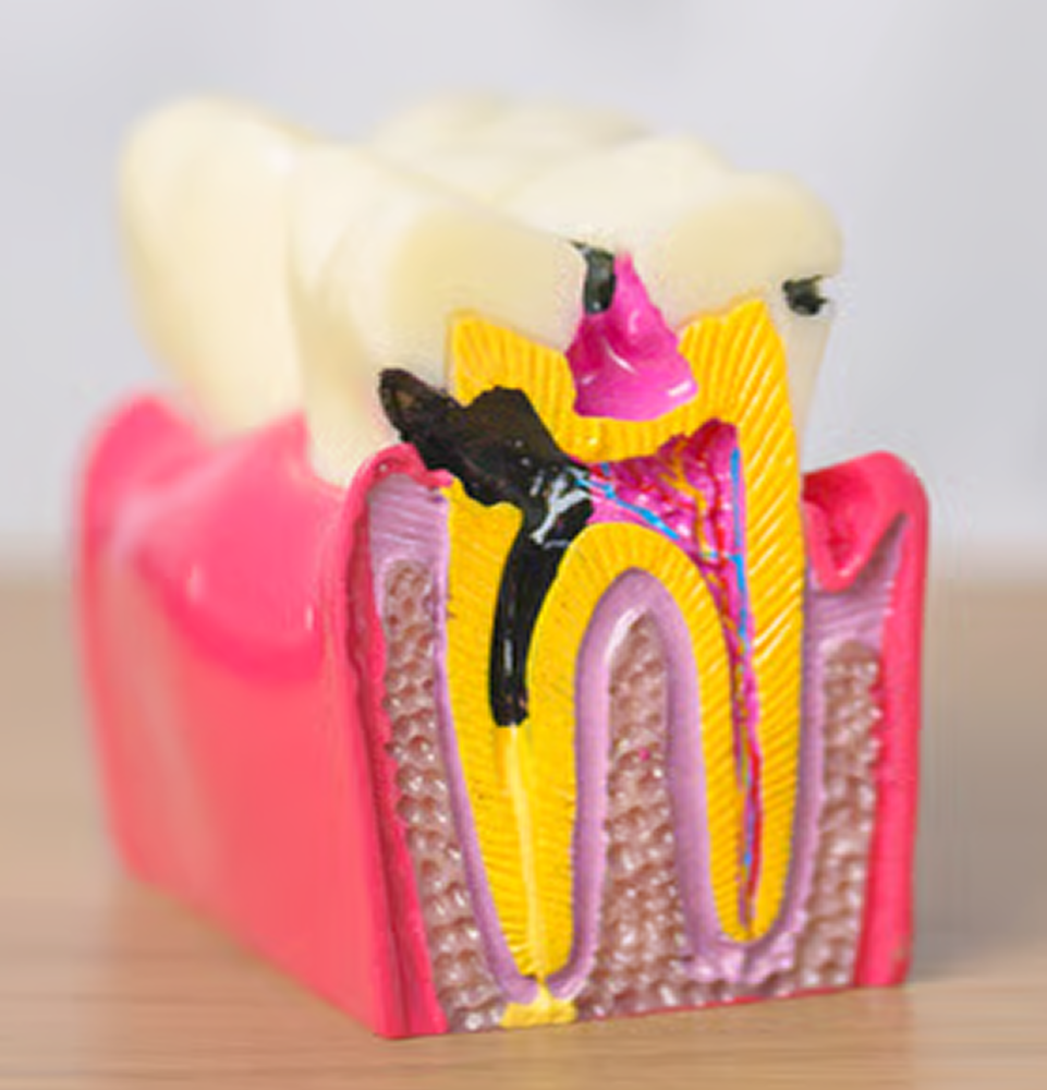 GN Dental Yuba City | Implant GN Dental Yuba City | Implant